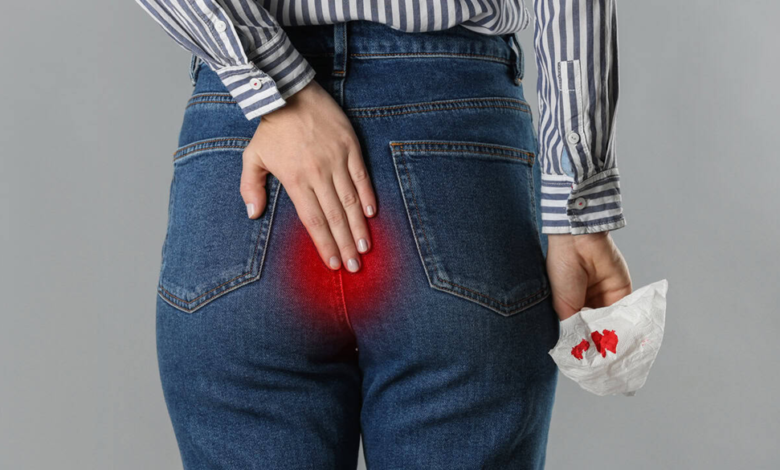 Beat Hemorrhoids at Home with These Easy Treatments
